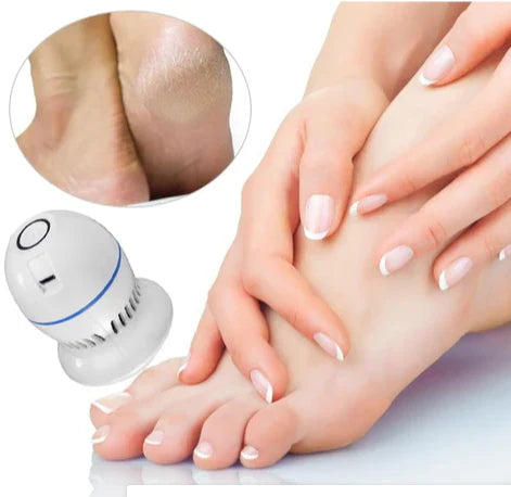 Beauty Feet | Removedor de callos y grietas + REGALO SORPRESA